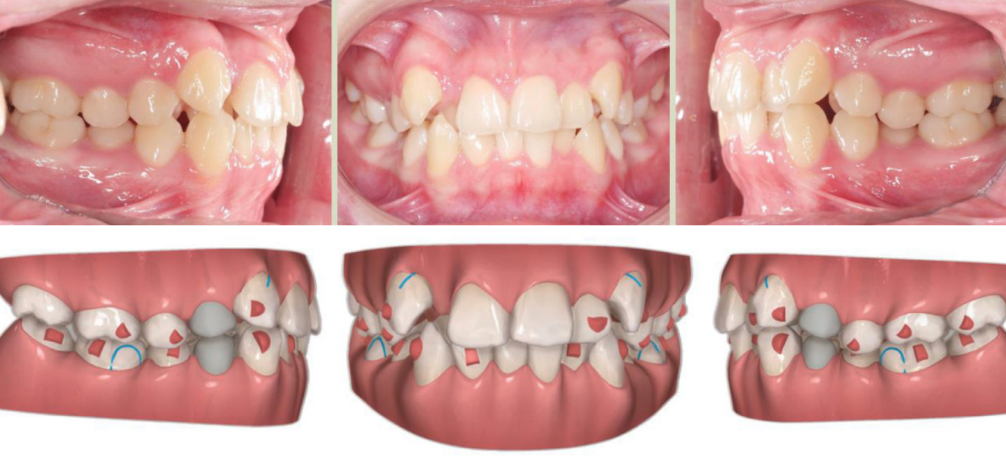 Case 2